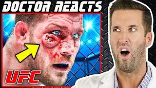 ER Doctor REACTS to Worst MMA Injuries in UFC History [upl. by Clarice766]