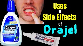 Orajel – Side Effects Uses Mechanism of Action Dosage Interactions Warnings [upl. by Tewell]