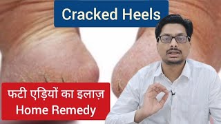 फटी एड़ियों का इलाज़ Cracked Heel Home Remedy crackedheels crackedheelsremedy crackedheelstreatment [upl. by Gnues448]