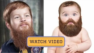 How to grow beard faster in 1 week  best way to grow a beard with 14 Secret Tricks [upl. by Labanna]