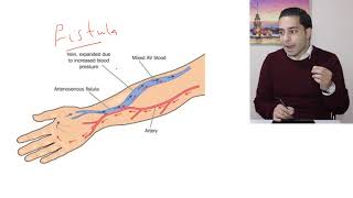 Renal Diseases  مقدمة عن الدروس السريرية لأمراض الكلية [upl. by Ahsekin826]