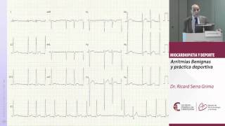 Arritmias benignas y práctica deportiva Dr Ricard Serra Grima [upl. by Eikin]