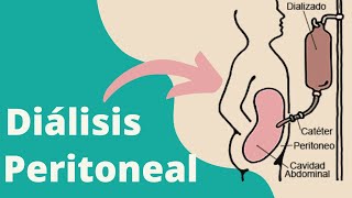 ¿Qué es la diálisis peritoneal [upl. by Elocn]