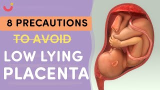 Unlock the Secrets to a Healthy Pregnancy How to Cure Low Lying Placenta Naturally [upl. by Jonas]