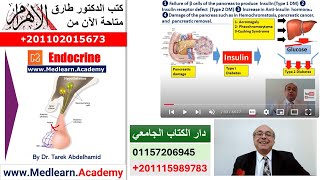 Diabetes Mellitus 1 Introduction cme internalmedicine medical usmle محاضراتباطنة [upl. by Ezequiel]