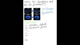 Identify The Syndrome and List the Features Syndromes MedicalMnemonics [upl. by Jarietta]