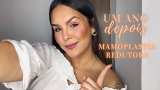 MAMOPLASTIA REDUTORA  CICATRIZ ANTES E DEPOIS ME ARREPENDI 1 ANO DEPOIS [upl. by Ettedanreb912]