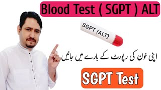 SGPT  ALT Blood Test in Urdu Hindi  SGPT Normal Range Treatment amp Diet  Irfan Azeem [upl. by Sulecram611]