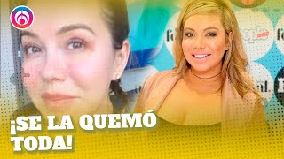 Chiquis Rivera se hace nuevo tratamiento en la cara [upl. by Seligman422]