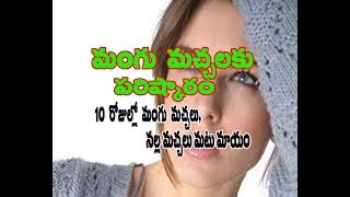 Tips to Reduce Mangu Machalu At Home Remedy OR Remove Pigmentation and Black Spots in Telugu [upl. by Glori]