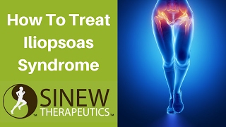 How To Treat Iliopsoas Syndrome and Speed Recovery [upl. by Stromberg]