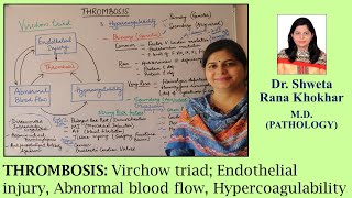 THROMBOSIS Virchow triad Endothelial injury Abnormal blood flow Hypercoagulability [upl. by Aneahs]