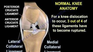 Knee Dislocations  Everything You Need To Know  Dr Nabil Ebraheim [upl. by Tezzil309]