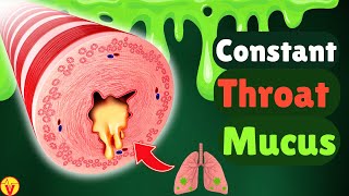 6 Real Causes of Phlegm amp Mucus in Your Throat Stop Constant Throat Clearing  VisitJoy [upl. by Mikes]