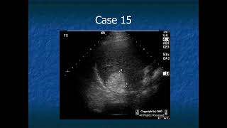 RADIOLOGY EXAM CASES [upl. by Rojam]