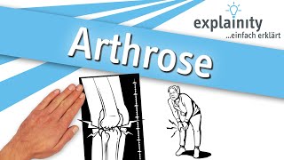 Arthrose einfach erklärt explainity® Erklärvideo [upl. by Sunev633]