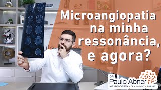 Microangiopatia na minha ressonância e agora [upl. by Sexela]