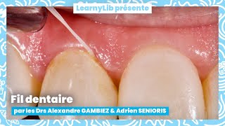 🦷 Motivation à lhygiène  le fil dentaire avec les Drs GAMBIEZ amp SENIORIS [upl. by Treulich]