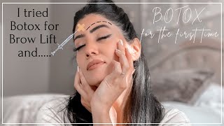 I tried Botox for the first time for Brow Lift and  Botox injection Before and after  By Sarv [upl. by Ramunni]