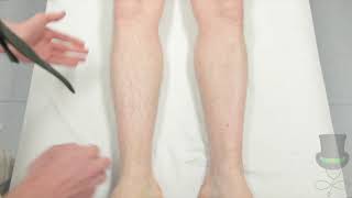 Assessment of the legs for deep vein thrombosis [upl. by Dixil921]