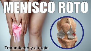 ROTURA de MENISCO 🦵🏼¿Cómo Saber Si Hay Una Lesión De Menisco 🦵🏼 Cirugía Terapia ⭐ Dr EDSON SERRANO [upl. by Pleasant]