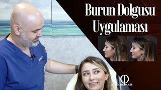 Burun Dolgusu Nasıl Yapılır Uygulamalı Anlatım  CLINICPLAST [upl. by Atinob]