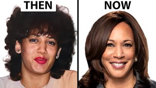 Kamala Harris NEW FACE  Plastic Surgery Analysis [upl. by Smiley]