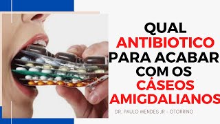 Caseos amigdalianos é importante tomar algum antibiótico para evitar que apareçam [upl. by Brittne]