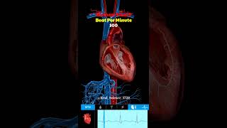 BPM 100 Vs BPM 16 Human Heart 🫀  3D Medical Animation shorts [upl. by Antoinette]