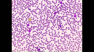 Crenated RBCs WBCs Pig Blood smear [upl. by Eram210]