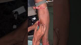 Iv injection viralvideo li [upl. by Verdha]