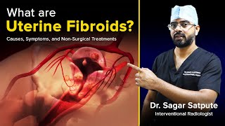 Understanding Uterine Fibroids Causes Symptoms amp NonSurgical Treatments  Dr Sagar Satpute [upl. by Ras]