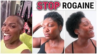 WHY I STOPPED USING ROGAINE  NATURAL HAIR UPDATE  NEW HAIR FT ALI BEAUTY FOREVER [upl. by Ogirdor]