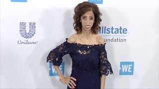 Lizzie Velasquez 2017 quotWE Dayquot California Event [upl. by Yroger]