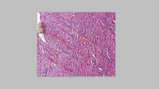 Histology Granulation Tissue [upl. by Mick]