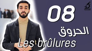 8  كيفية التعامل مع مختلف الحروق ؟ Que faire devant les différents types de brûlures [upl. by Aneloaup]