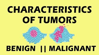 Characteristics Of Tumor Pathology  Characteristics Of Tumor Cells medicine pathology [upl. by Myrlene333]