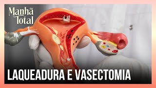 Laqueadura e vasectomia Saiba mais sobre as novas regras desses procedimentos  MANHÃ TOTAL [upl. by Areyk]