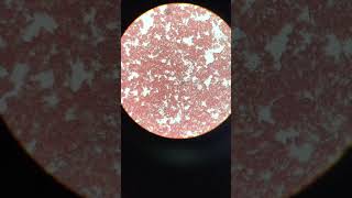 Heartworm microfilaria blood smear [upl. by Nehtanhoj257]