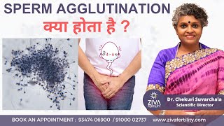 Sperm Agglutination क्या होता है   Causes And Treatment  Male Infertility  Dr C Suvarchalaa [upl. by Ganiats425]