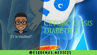 CETOACIDOSIS DIABÉTICA  CONCEPTOS BÁSICOS [upl. by Atteynad870]