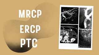 Role of MRCP ERCP and PTC in diseases of bile ducts neetpg usmle fmge [upl. by Osric]