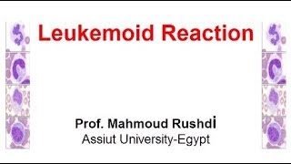 Leukemoid Reaction Arabic 2017 [upl. by Hughie]