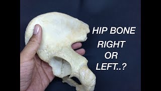 HIP BONE  SIDE DETERMINATION amp ANATOMICAL POSITION [upl. by Jereme997]