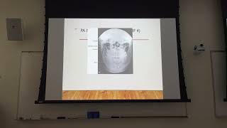 Radiography of the Mandible and TMJs [upl. by Ramin]