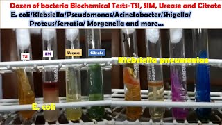 Various Bacteria Biochemical Tests E coli KlebsiellaPseudomonasAcinetobacterProteusMongenella [upl. by Thormora876]