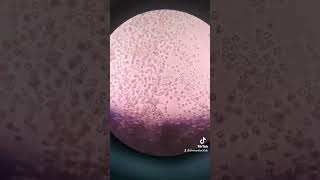 How to do urinalysis laboratory medtechstudent medtech microscope urinalysis urine [upl. by Gelman]