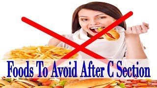 8 Common Foods To Avoid After C Section To Stay Fit [upl. by Khan]