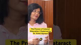 Cataract Progression ।Dr Vishal Agrawal eudaemoniaquest [upl. by Assillem]