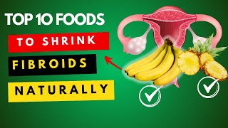 Top 10 foods to shrink fibroids naturally and fast [upl. by Ury333]